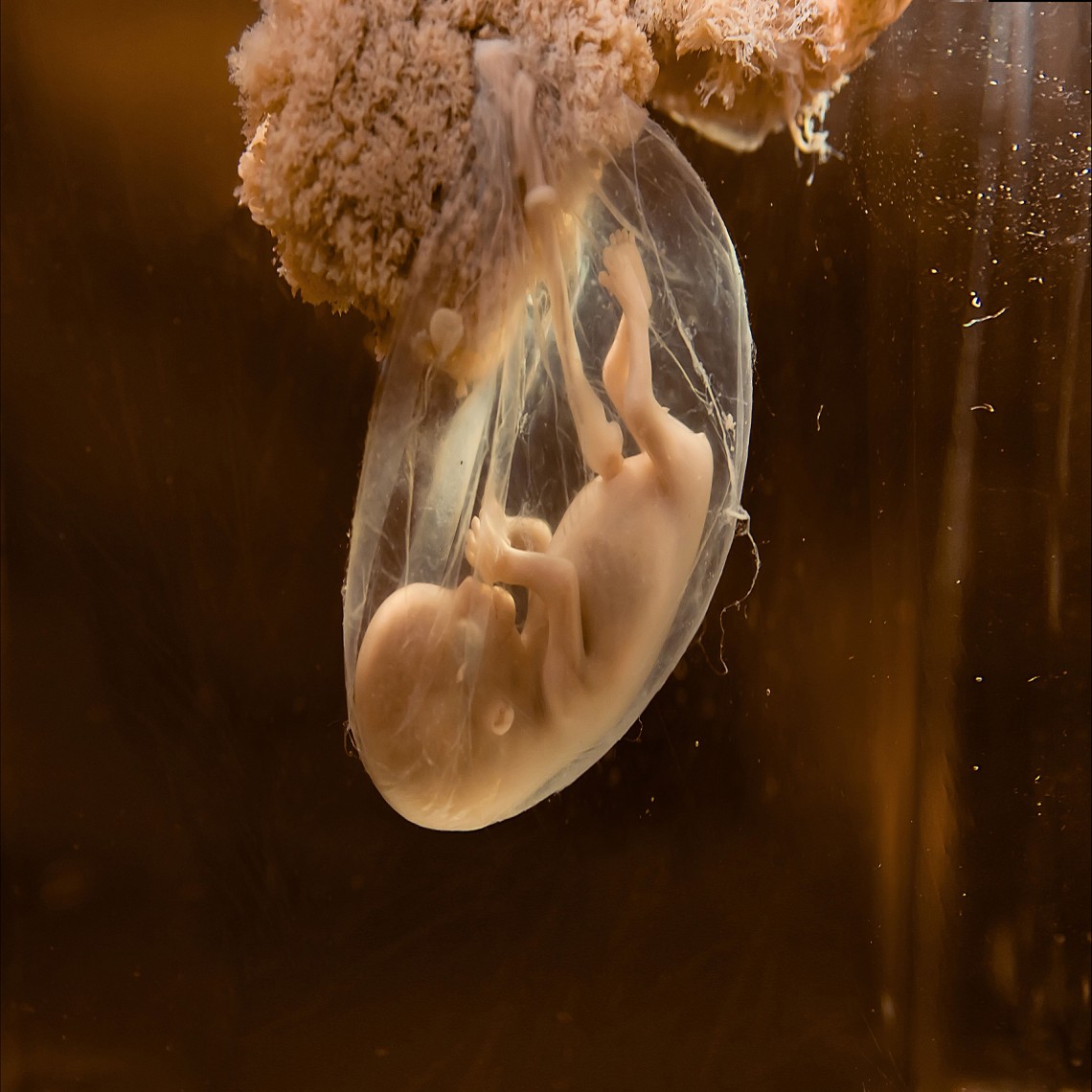 The Quran on Human Embryonic Development